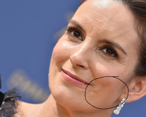 Tina Fey Facial Scar